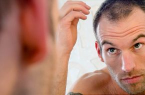 Natural hair loss treatment
