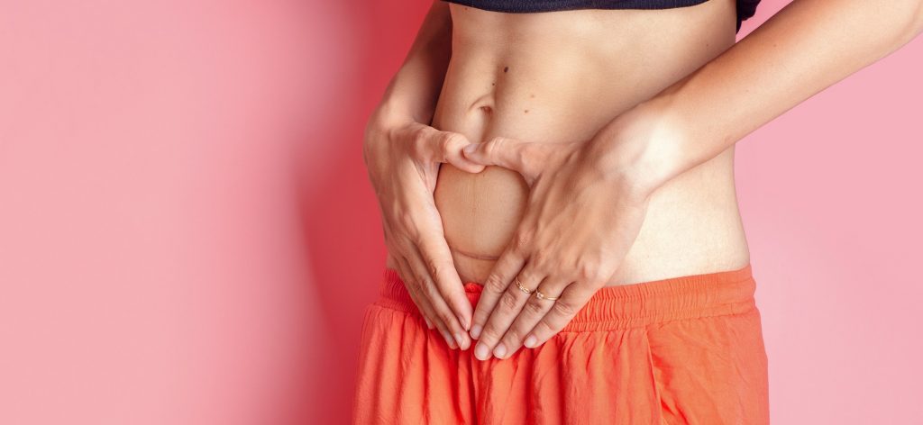 Diastasis Recti: What Can You Do To Cure This Problem?