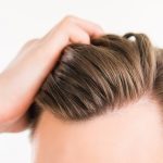 Before Getting a Hair Transplant, Here Are Important Facts You Should Know